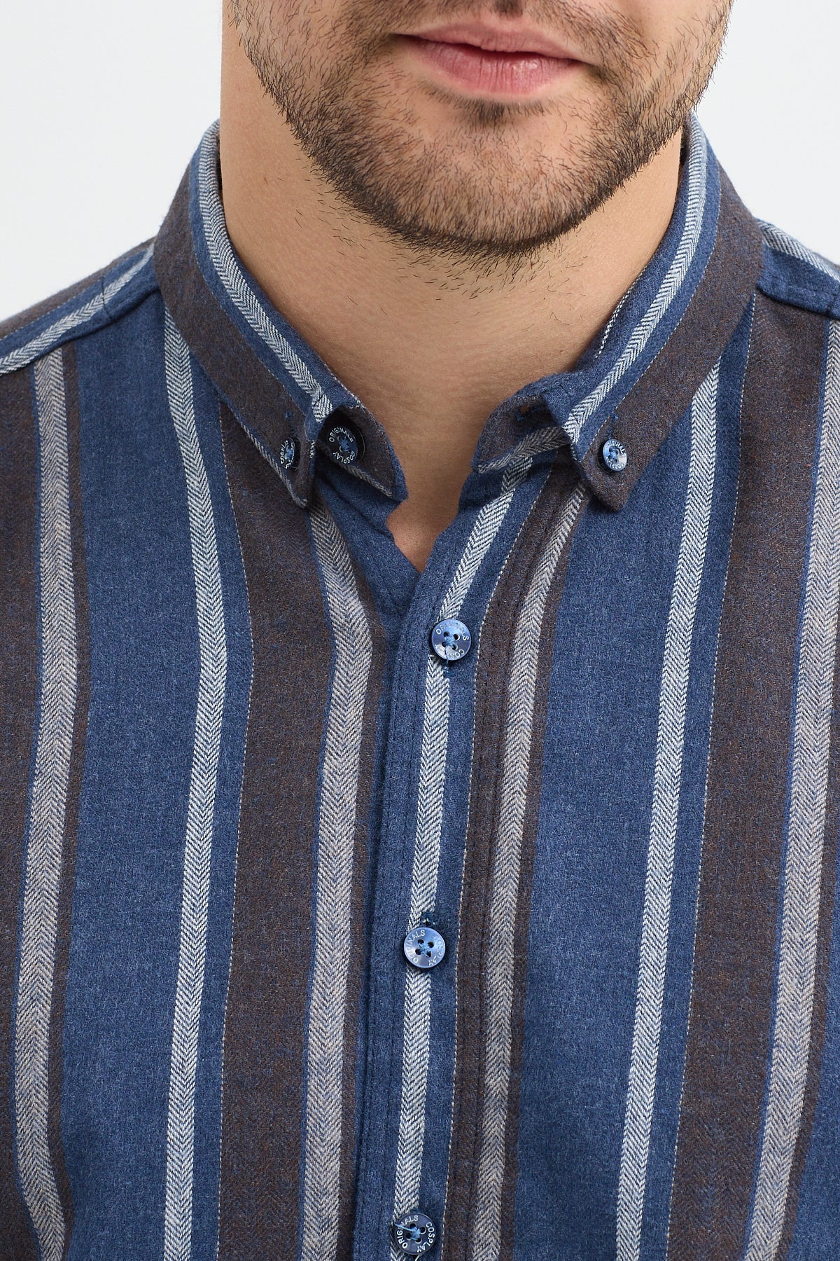 Cosplay Erkek Melanj Dikine Çizgili Button Down Regular Fit Gömlek